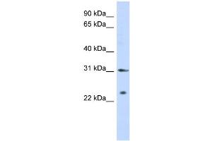 WB Suggested Anti-SSX5 Antibody Titration:  0. (SSX5 Antikörper  (Middle Region))
