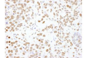 Immunohistochemistry (IHC) image for anti-Heterogeneous Nuclear Ribonucleoprotein L (HNRNPL) (AA 350-400) antibody (ABIN7795591) (HNRNPL Antikörper  (AA 350-400))