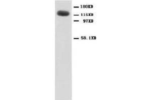 NMDAR1 Polyclonal Antibody (NMDA 1 Receptor Antikörper  (N-Term))