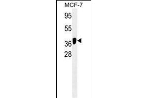 ATG4B/M antibody (ABIN659121 and ABIN2843761) western blot analysis in MCF-7 cell line lysates (35 μg/lane). (ATG4B Antikörper)