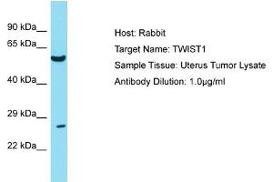 Host: Rabbit Target Name: TWIST1 Sample Tissue: Human Uterus Tumor Antibody Dilution: 1ug/ml (TWIST1 Antikörper  (N-Term))