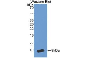 Detection of Recombinant SCCA2, Human using Monoclonal Antibody to Serpin Peptidase Inhibitor,Clade B,Member 4 (SERPINB4) (SERPINB4 Antikörper  (AA 144-298))