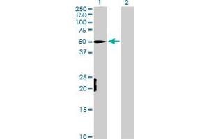 Western Blot analysis of MEF2D expression in transfected 293T cell line by MEF2D MaxPab polyclonal antibody. (MEF2D Antikörper  (AA 1-521))