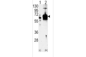 Western blot analysis of GUCY1A3 using GUCY1A3 Antibody using 293 cell lysates (2 ug/lane) either nontransfected (Lane 1) or transiently transfected with the GUCY1A3 gene (Lane 2). (GUCY1A1 Antikörper  (N-Term))
