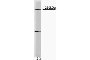 Western blot analysis of Nestin on a rat (E17) cerebrum lysate. (Nestin Antikörper  (AA 402-604))