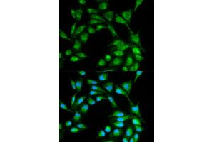 Immunofluorescence analysis of MCF-7 cells using ICOS antibody (ABIN5970917). (ICOS Antikörper)