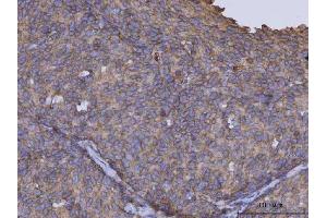 IHC analysis of ARL1 using anti-ARL1 antibody (ABIN7602848). (ARL1 Antikörper  (C-Term))