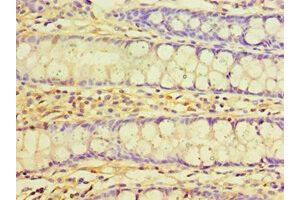 Immunohistochemistry of paraffin-embedded human colon tissue using ABIN7173568 at dilution of 1:100 (TNNC2 Antikörper  (AA 1-160))