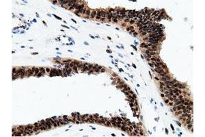 Image no. 17 for anti-EPM2A (Laforin) Interacting Protein 1 (EPM2AIP1) antibody (ABIN1498047) (EPM2AIP1 Antikörper)