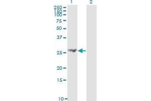 Western Blotting (WB) image for anti-Fibroblast Growth Factor 21 (FGF21) (AA 30-209) antibody (ABIN565264)