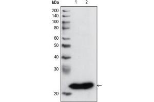 Western blot analysis using GSTP1 mouse mAb against PC3 cell lysate (1) and human cerebellum tissue lysate (2). (GSTP1 Antikörper)