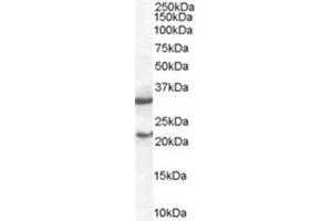Image no. 1 for anti-Suppressor of Cytokine Signaling 1 (SOCS1) (C-Term) antibody (ABIN374072)