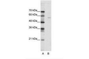 Image no. 1 for anti-ELK1, Member of ETS Oncogene Family (ELK1) (N-Term) antibody (ABIN202499) (ELK1 Antikörper  (N-Term))