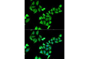 Immunofluorescence analysis of A549 cells using GALE antibody. (GALE Antikörper  (AA 129-348))