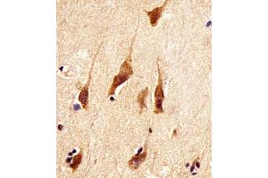 (ABIN6242191 and ABIN6578387) staining ARRB2 in human brain tissue sections by Immunohistochemistry (IHC-P - paraformaldehyde-fixed, paraffin-embedded sections). (Arrestin 3 Antikörper  (AA 264-298))