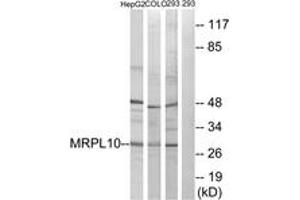 Western blot analysis of extracts from 293/HepG2/COLO cells, using MRPL10 Antibody.
