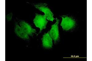 Immunofluorescence of monoclonal antibody to NOTCH2NL on HeLa cell.