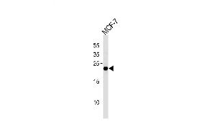 Lane 1: MCF-7 Cell lysates, probed with MGMT (888CT22. (MGMT Antikörper)