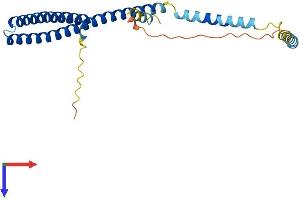 CHMP4A Protein (AA 1-222) (His tag)