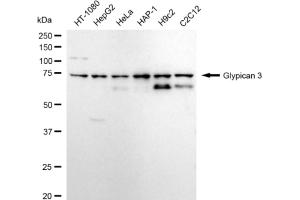 Western blotting analysis using Glypican 3 antibody (ABIN7798789).