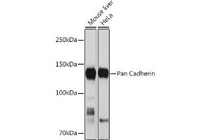 Western blot analysis of extracts of various cell lines, using Pan Cadherin Rabbit mAb (ABIN1679719, ABIN3019268, ABIN3019269 and ABIN7101741) at 1:1000 dilution. (CDH1,CDH2,CDH3,CDH4 Antikörper)