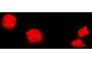 Immunofluorescent analysis of Cholinesterase staining in U2OS cells. (Butyrylcholinesterase Antikörper)