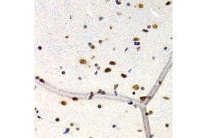 Immunohistochemistry of paraffin-embedded rat brain using MT2A antibody (ABIN1873764) at dilution of 1:200 (40x lens). (MT2A Antikörper)
