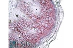 AP31715PU-N DSG1 antibody staining of paraffin embedded Human skin at 3. (Desmoglein 1 Antikörper  (Internal Region))