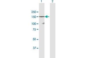 Western Blot analysis of DSG1 expression in transfected 293T cell line by DSG1 MaxPab polyclonal antibody. (Desmoglein 1 Antikörper  (AA 1-1049))