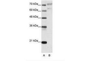 Image no. 1 for anti-Apoptosis Antagonizing Transcription Factor (AATF) (N-Term) antibody (ABIN202765)