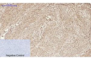 Immunohistochemical analysis of paraffin-embedded human uterus tissue.