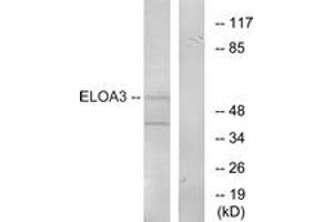 Western blot analysis of extracts from COLO205 cells, using ELOA3 Antibody. (TCEB3C Antikörper  (AA 381-430))
