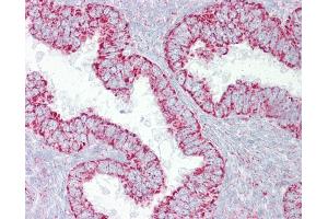 Anti-PDGFB antibody IHC of human uterus. (PDGF-BB Homodimer (N-Term) Antikörper)