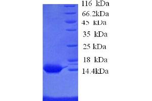 SDS-PAGE (SDS) image for Serum Amyloid A (SAA) (AA 1-110), (full length) protein (His tag) (ABIN5713810) (SAA Protein (AA 1-110, full length) (His tag))