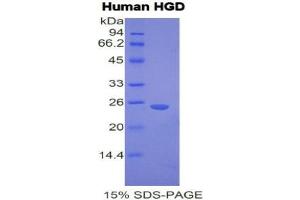 SDS-PAGE (SDS) image for Homogentisate 1,2-Dioxygenase (HGD) (AA 8-205) protein (His tag) (ABIN1170657) (HGD Protein (AA 8-205) (His tag))