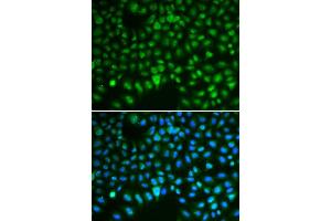 Immunofluorescence (IF) image for anti-Discs, Large (Drosophila) Homolog-Associated Protein 5 (DLGAP5) (AA 547-846) antibody (ABIN3023190) (DLGAP5 Antikörper  (AA 547-846))
