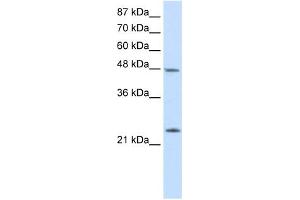Western Blot showing CBX6 antibody used at a concentration of 1-2 ug/ml to detect its target protein. (CBX6 Antikörper  (N-Term))