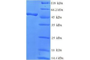 SDS-PAGE (SDS) image for Rabphilin 3A-Like (Without C2 Domains) (RPH3AL) (AA 1-315), (full length) protein (His-SUMO Tag) (ABIN5711959)