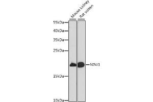Western blot analysis of extracts of various cell lines, using NINJ1 antibody (ABIN7268918) at 1:1000 dilution. (NINJ1 Antikörper  (AA 1-100))