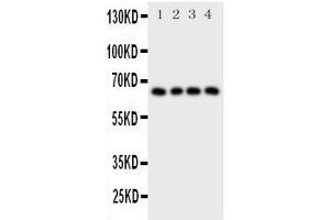 Western Blotting (WB) image for anti-Parathyroid Hormone 1 Receptor (PTH1R) (AA 388-406), (C-Term) antibody (ABIN3043983)