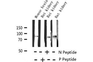 Western blot analysis of Phospho-Tau (Ser214) expression in various lysates (MAPT Antikörper  (pSer214))