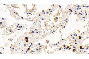 Immunohistochemistry (IHC) image for anti-BCL2-Like 1 (BCL2L1) (AA 2-212) antibody (ABIN7426781)