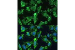 Immunofluorescence analysis of U-2 OS cells using ENO1 antibody (ABIN3021299, ABIN3021300, ABIN3021301, ABIN1512865 and ABIN6214545) at dilution of 1:100. (ENO1 Antikörper  (AA 1-434))