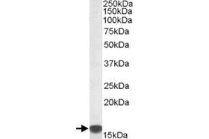 S100A9 polyclonal antibody  (0. (S100A9 Antikörper)