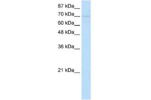 WB Suggested Anti-ZNF282 Antibody Titration:  1. (ZNF282 Antikörper  (N-Term))