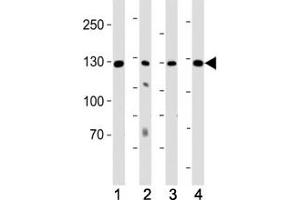 Western blot analysis of lysate from (1) K562 cell line, (2) human lung, (3) mouse kidney and (4) mouse heart tissue using ROR1 antibody at 1:1000. (ROR1 Antikörper)