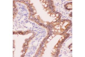 Anti-CTNNA1 Picoband antibody,  IHC(P): Rat Intestine Tissue