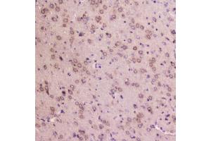 Immunohistochemistry (IHC) image for anti-Insulin-Like Growth Factor Binding Protein 2, 36kDa (IGFBP2) (AA 35-304) antibody (ABIN6654166)