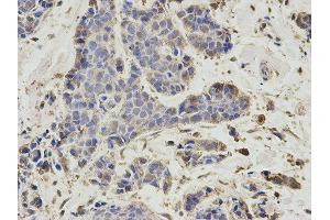 Immunohistochemistry (IHC) image for anti-Proteasome (Prosome, Macropain) 26S Subunit, Non-ATPase, 7 (PSMD7) antibody (ABIN1876544) (PSMD7 Antikörper)