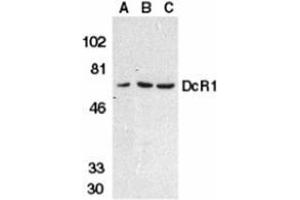 Western blot analysis of DcR1 in HeLa cell (A), mouse (B) and rat (C) liver tissue lysates with AP30279PU-N DcR1 antibody at 1 μg/ml. (DcR1 Antikörper)
